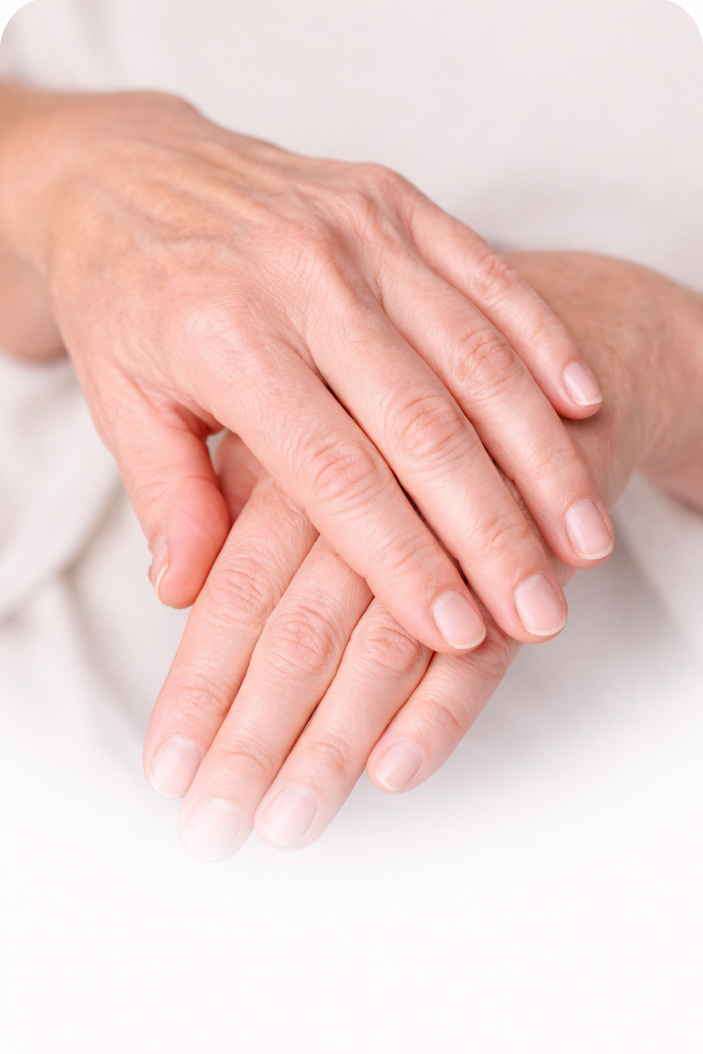 Seringue de Hyafilia V Plus – acide hyaluronique réticulé avec lidocaïne pour correction des volumes (pommettes, menton)